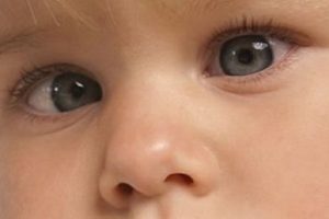 Bebeklerde Göz Kayması Neden Olur?
