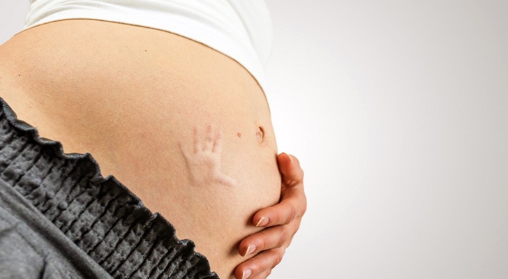 Hamilelik çatlakları nasıl önlenir?
