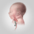 Bebeğinde Doğuştan Yemek Borusu Problemi(özofagus atrezisi)